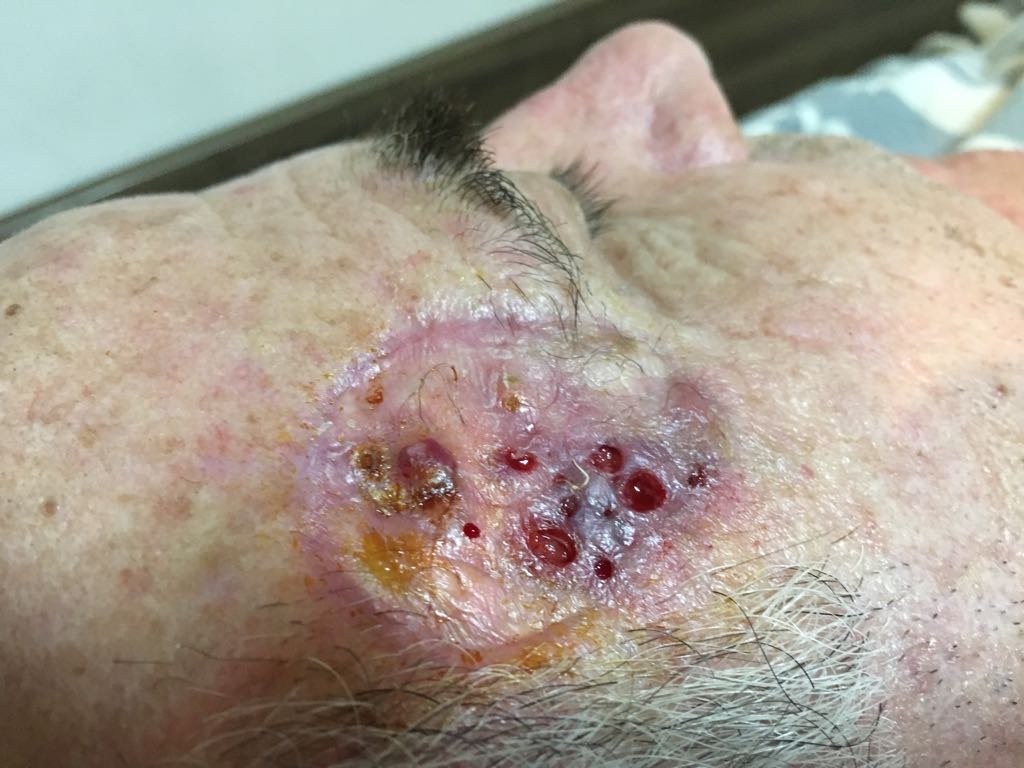 Senhor com ferida na tempora direita